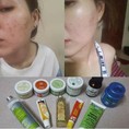 Chăm sóc da mặt với mỹ phẩm Ấn Độ