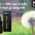 Serum NANCY CARE trị mụn dứt điểm hiệu quả trong 2 tuần