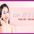 Giải đáp các thắc mắc về công nghệ PRP trị sẹo rỗ