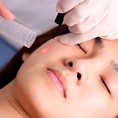 Bộ Obagi Nuderm trị nám tàn nhang