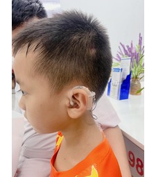 Địa chỉ đáng tin cậy để mua máy trợ thính tại Thanh Hóa.