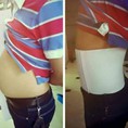 SLINE định hình vòng 2
