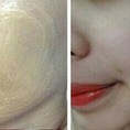 Hấp trăng phủ trăng da tái sinh và điều trị nám thâm sâu lâu năm Tại Thanhhang Beauty