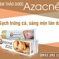 Azacné mua ở đâu