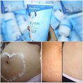 Kem trị rạn da gerber thần thánh