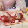 Bà bầu cần bổ sung dinh dưỡng như thế nào để ngăn ngừa thiếu máu thiếu sắt
