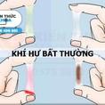 Địa chỉ điều trị khí hư bất thường ở đâu tốt nhất Thanh Hóa 2021