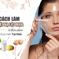 Những lưu ý khi tìm đến cách làm mặt nạ lột mụn tại nhà