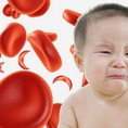 Cách bổ sung sắt cho trẻ sơ sinh bị thiếu máu hiệu quả
