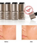 Hình ảnh: Mỹ phẩm tinh chất trị nám từ Vitamin C Mesoestetic A Plus