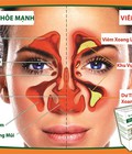 Hình ảnh: Thảo dược Doctor Ninh trị viêm xoang hiệu quả tốt nhất