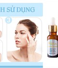 Hình ảnh: Cách trị mụn tân gốc