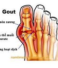 Hình ảnh: Giầy dành cho bệnh nhân tiểu đường