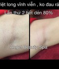 Hình ảnh: Angel Beauty Spa