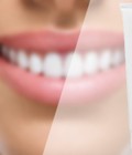 Hình ảnh: Kem đánh răng USA 100% thiên nhiên, đặc trị các bệnh về răng miệng