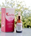 Hình ảnh: Serum trị mụn Acnes Serum