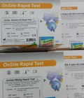 Hình ảnh: Test thử nhanh Onsite HEV CTK