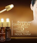 Hình ảnh: Vĩnh biệt làn da mụn với Acne Extract Serum (Serum trị mụn)