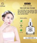 Hình ảnh: Serum trị mụn, khỏi mụn 100%