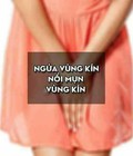 Hình ảnh: Kén đặt phụ khoa, sản phẩm trị dứt điểm viêm nhiễm phụ khoa