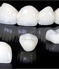 Hình ảnh: Làm răng sứ Cercon Ht và răng sứ Cercon Zirconia