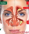 Hình ảnh: Bệnh viêm xoang nguyên nhân và các triệu chứng của bệnh.