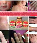 Hình ảnh: Kem mul rosr chuyên đặc trị các bệnh về da bôi được lên vết thương hở