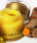 Hình ảnh: Kem trị sẹo Scar Care