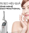 Hình ảnh: Trị sẹo bằng công nghệ laser co2 fractional