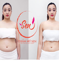 Hình ảnh: Giảm béo toàn thân tại Thẩm mỹ Sen