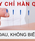 Hình ảnh: Cấy chỉ kim cương