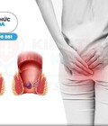 Hình ảnh: Chữa trĩ giá rẻ tại TP Thanh Hóa 2020