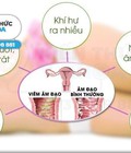 Hình ảnh: Chữa trị viêm âm đạo uy tín giá rẻ tại TP Thanh Hóa 2020