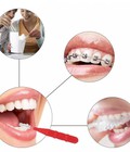 Hình ảnh: Tăm răng INOX cực kì tiện lợi, phù hợp với những người niềng răng
