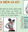 Hình ảnh: Bệnh thoát vị đĩa đệm: nguyên nhân, triệu chứng các cách điều trị hiệu quả