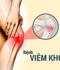 Hình ảnh: Bệnh viêm khớp tổng quan nguyên nhân, triệu chứng, khám, chữa bệnh