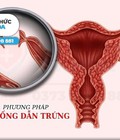 Hình ảnh: Địa chỉ chữa trị chậm kinh uy tín tại TP Thanh Hóa