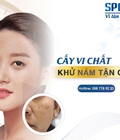 Hình ảnh: Thẩm Mỹ viện SPALA Điều trị nám tận gốc bằng phương pháp cấy vi chất tái sinh