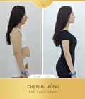 Hình ảnh: Giảm béo Liposonix