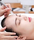 Hình ảnh: Trị mụn chuyên sâu ipl