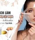 Hình ảnh: Những lưu ý khi tìm đến cách làm mặt nạ lột mụn tại nhà