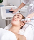 Hình ảnh: Xóa vết bớt đỏ trên mặt bằng công nghệ Laser Revlite