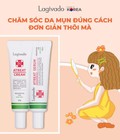 Hình ảnh: 5 cách chăm sóc da giúp diệt mụn trừ thâm hiệu quả