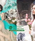 Hình ảnh: Nâng ngực bằng Breast Fit System có hiệu quả không