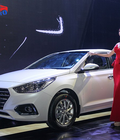 Hình ảnh: Dịch vụ thay kính chắn gió xe Hyundai Accent Tại nhà ở TP.HCM