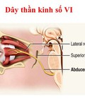 Hình ảnh: Sụp mí mắt khắc phục như thế nào