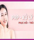Hình ảnh: Giải đáp các thắc mắc về công nghệ PRP trị sẹo rỗ