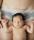 Hình ảnh: Đâu là trái cây tốt cho mẹ sau sinh mổ