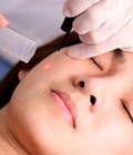 Hình ảnh: Bộ Obagi Nuderm trị nám tàn nhang