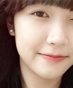 Bị nháy mắt và những điềm báo bất ngờ